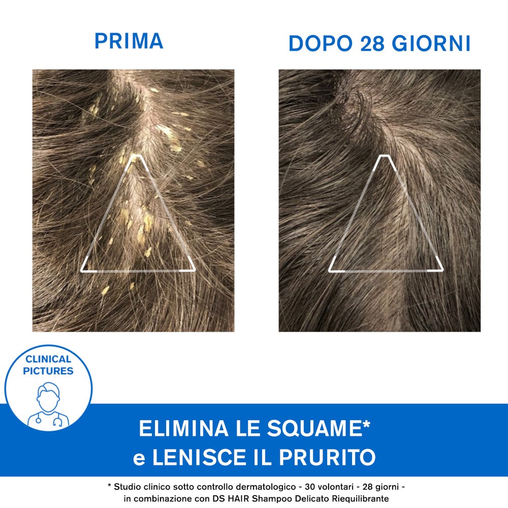 984837599 - URIAGE DS HAIR SHAMPOO CHERATORIDUTTORE 150 ML - 4741411_8.jpg