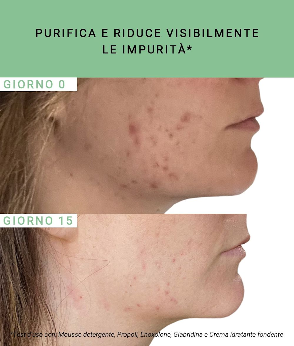 986333223 - ETAT PUR PROPOLIS 750PPM 15 ML - 4711063_3.jpg