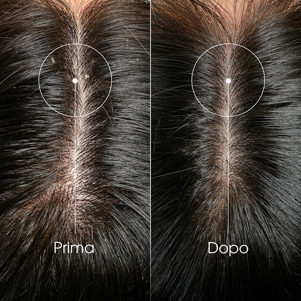 951124890 - KLORANE SHAMPOO TRATTANTE & RIEQUILIBRANTE GALANGA 400 ML 25 - 4842965_6.jpg