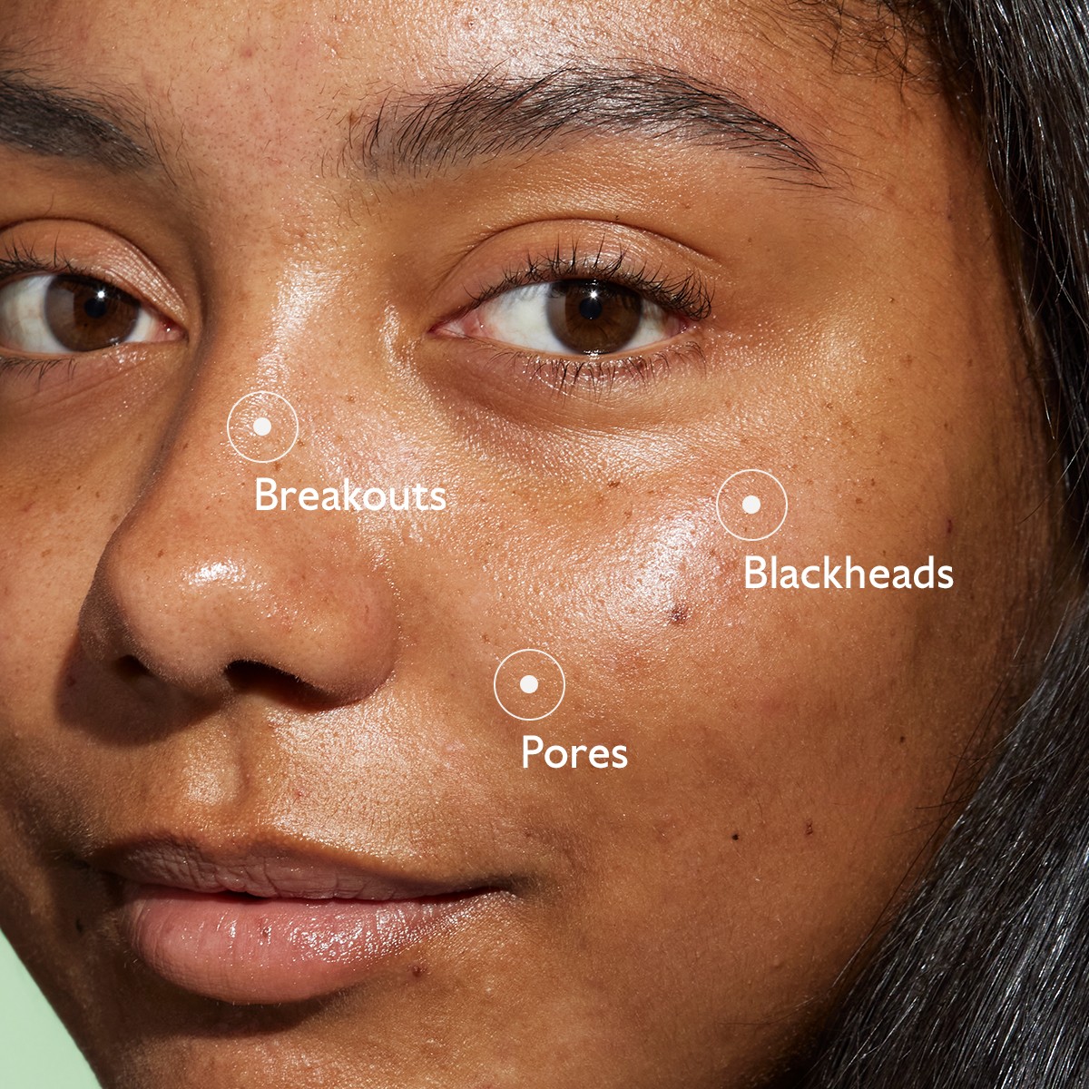 image - 950913640 - VINOPURE SIERO ANTI IMPERFEZIONI 30 ML - 4844547_5.jpg