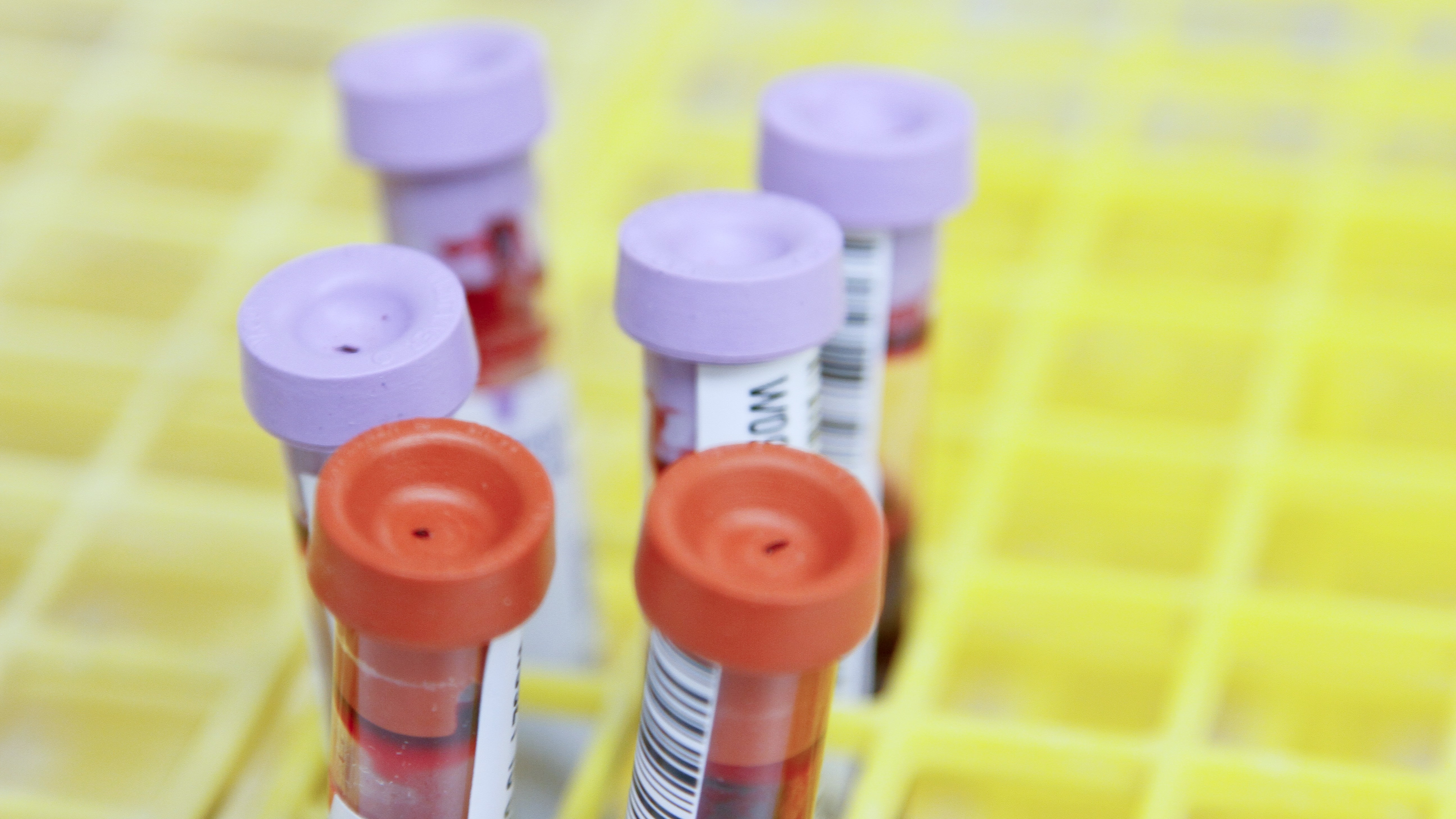Here's what you need to know about coronavirus antibody blood plasma