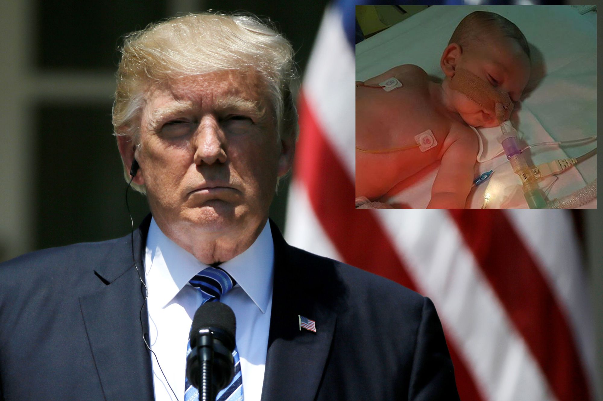 Donald Trump propose d'aider Charlie, un bébé anglais en phase terminale