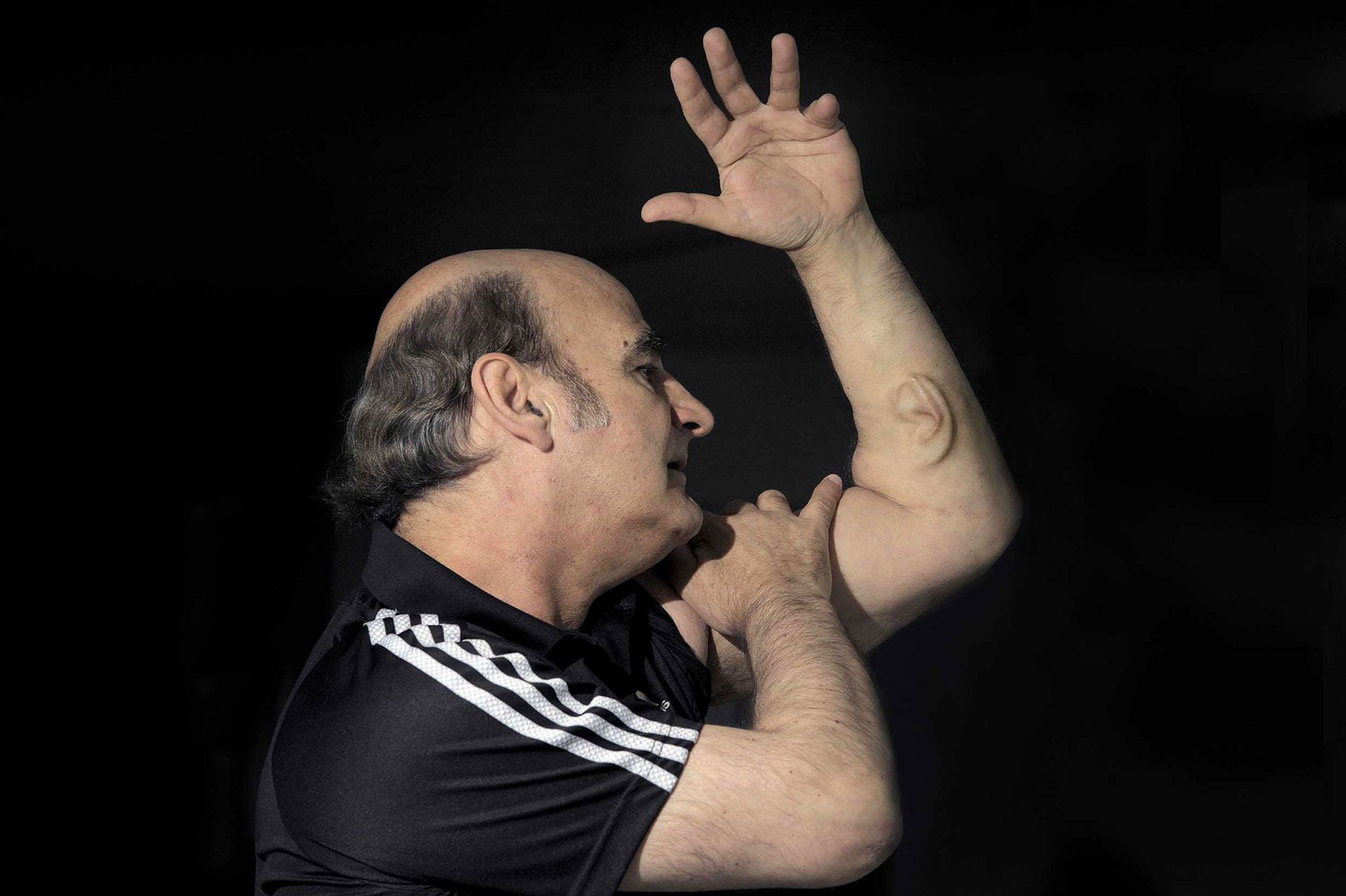 Stelarc se fait pousser une oreille dans le bras - Il va la connecter ...