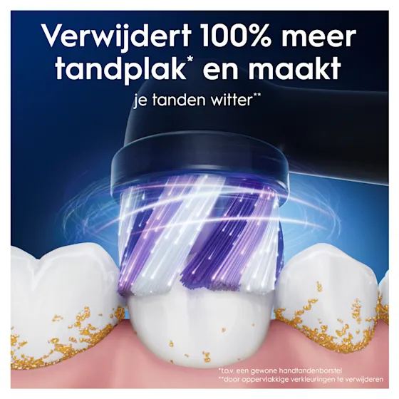 Oral-B iO 9 Wittere tanden Bundel