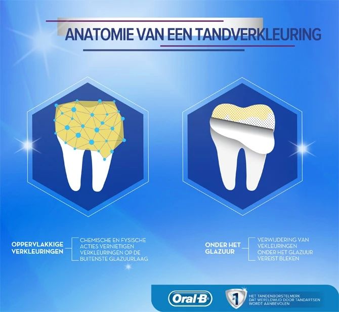 Inloggegevens optillen Kosmisch Tanden witter maken doe je met deze tips | Oral-B NL