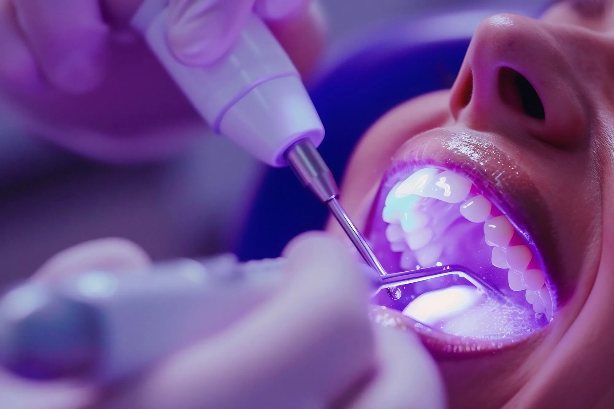Image - Article - Veelvoorkomende mondinfecties en hoe een goede mondhygiëne kan helpen - Hero