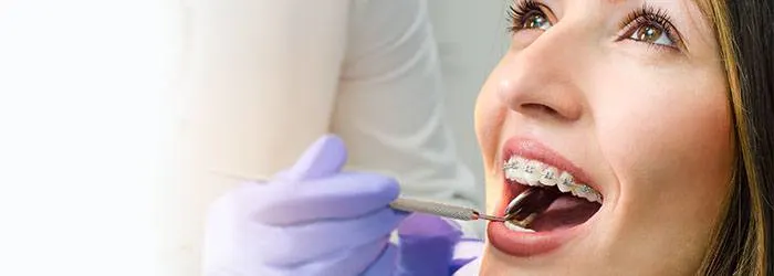 Afspraak orthodontist: wat staat je te wachten? article banner