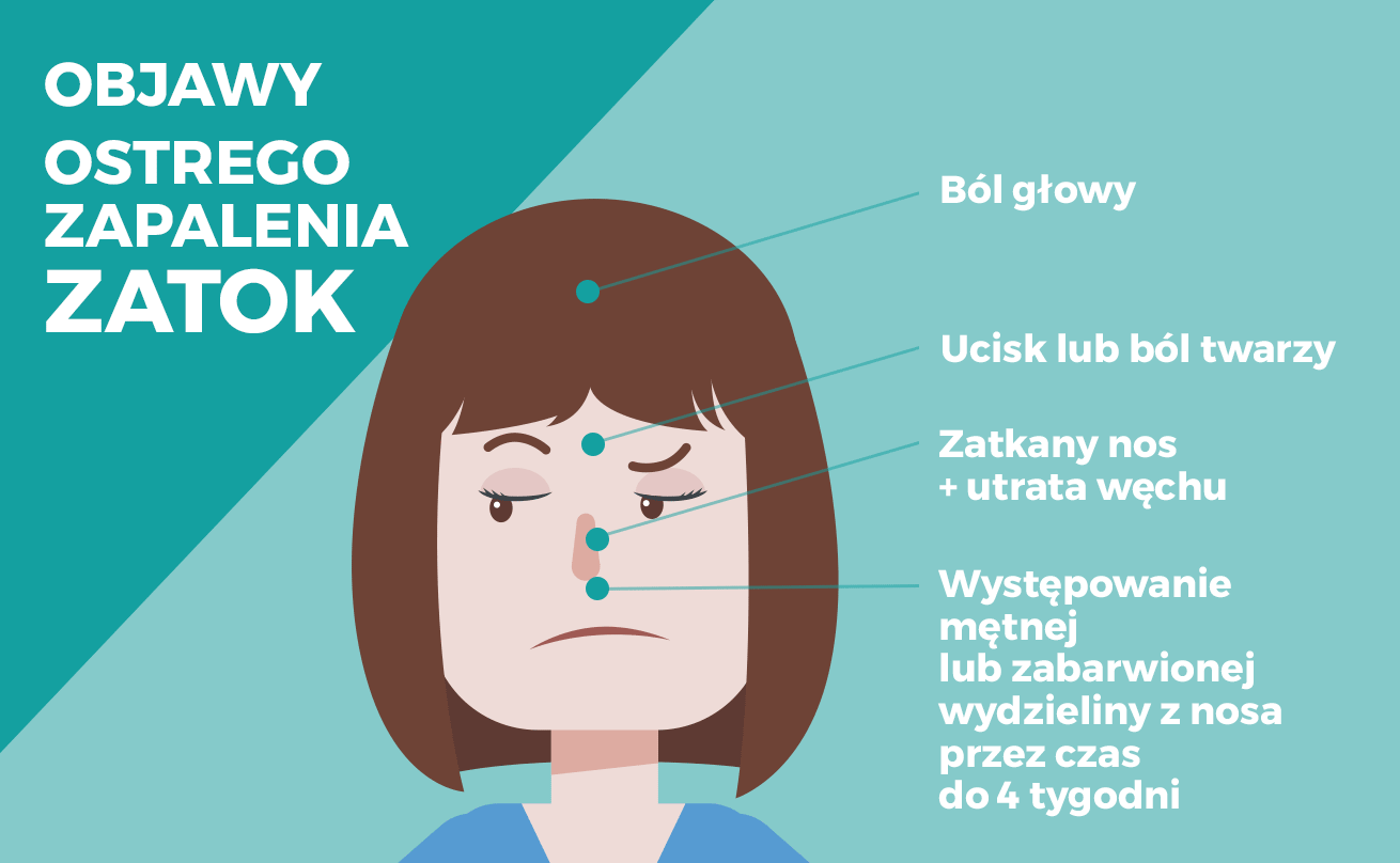 Симптомы синусита у взрослых. Синусит без температуры. Синусит симптомы у взрослых.