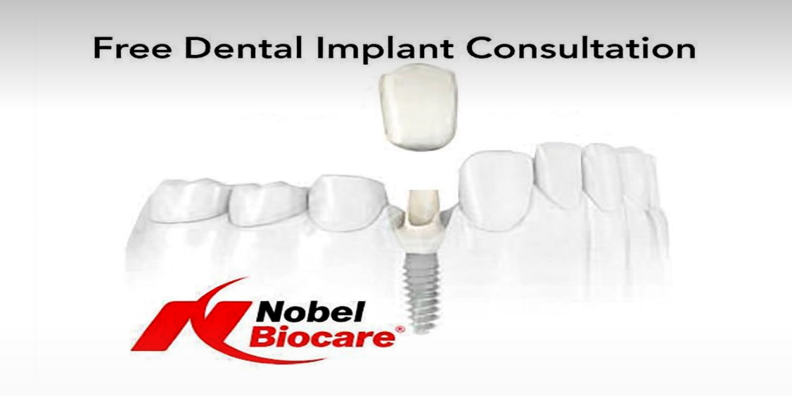 Free Dental Implant Consultation