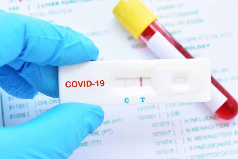 article image - corona-schnelltests-sicherheitsbranche