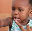 Que faire si bébé se casse une dent ?