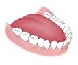 Teeth after 3-step routine