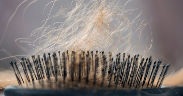 Hair loss can be caused by certain medications