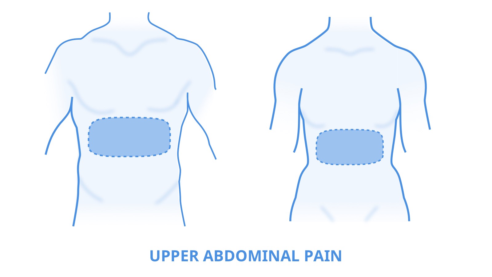 Image highlighting the upper abdomen