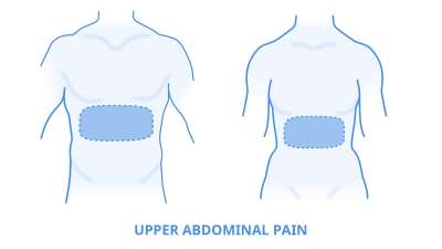 Can acid reflux cause pain in upper abdomen