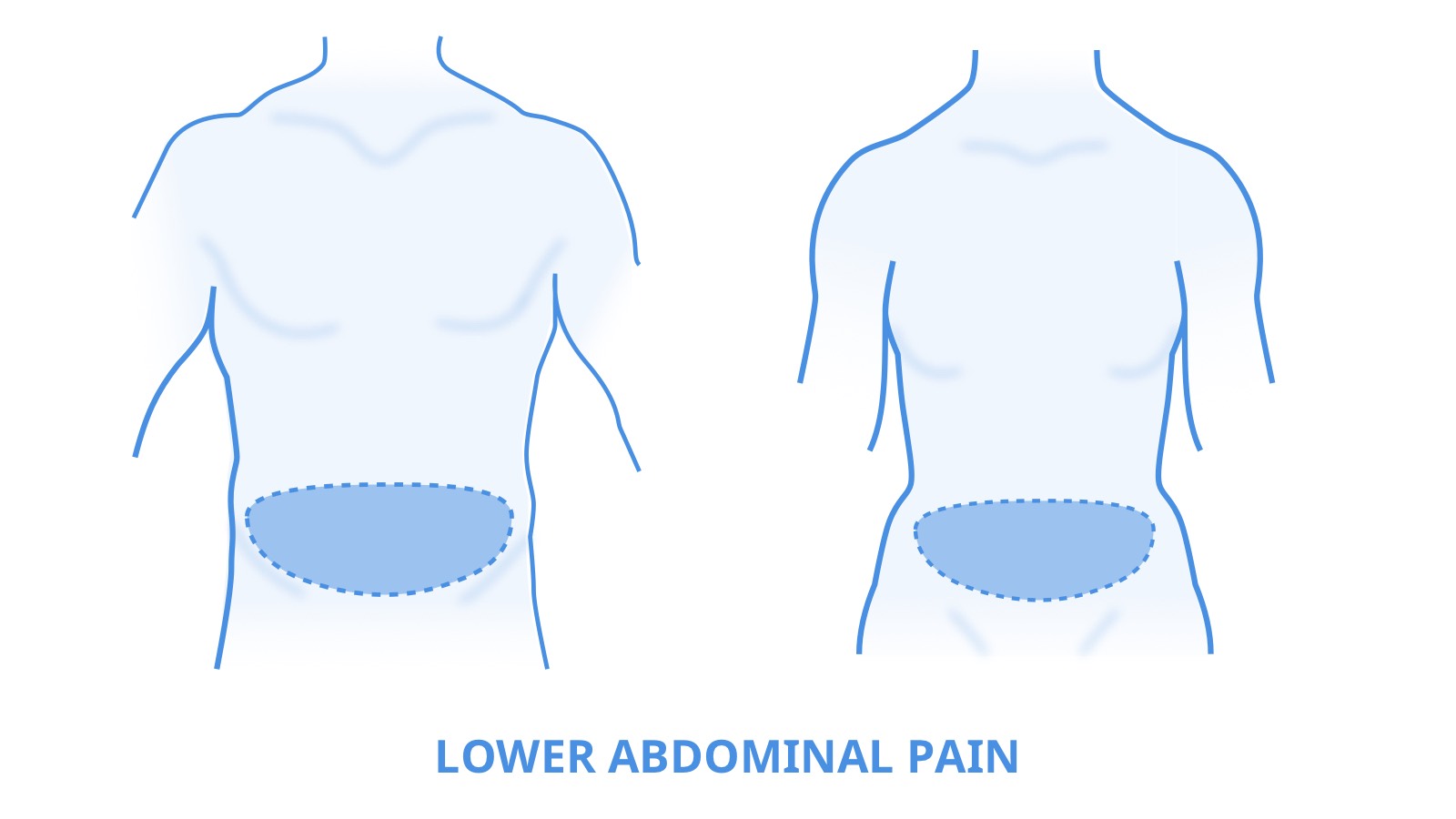 Image highlighting the lower abdomen