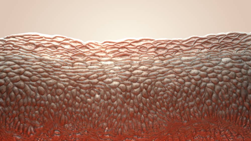 Close up of skin cells layers of skin for cellulitis