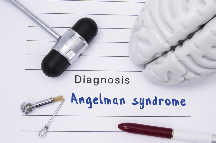 Neurological hammer and brain figure lie on a medical paper form with a heading diagnosis of Angelman syndrome on a table