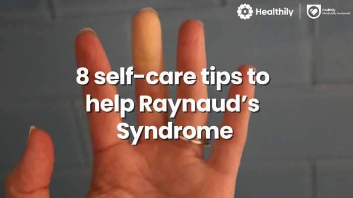 Video 8 self care tips for Raynaud s Syndrome