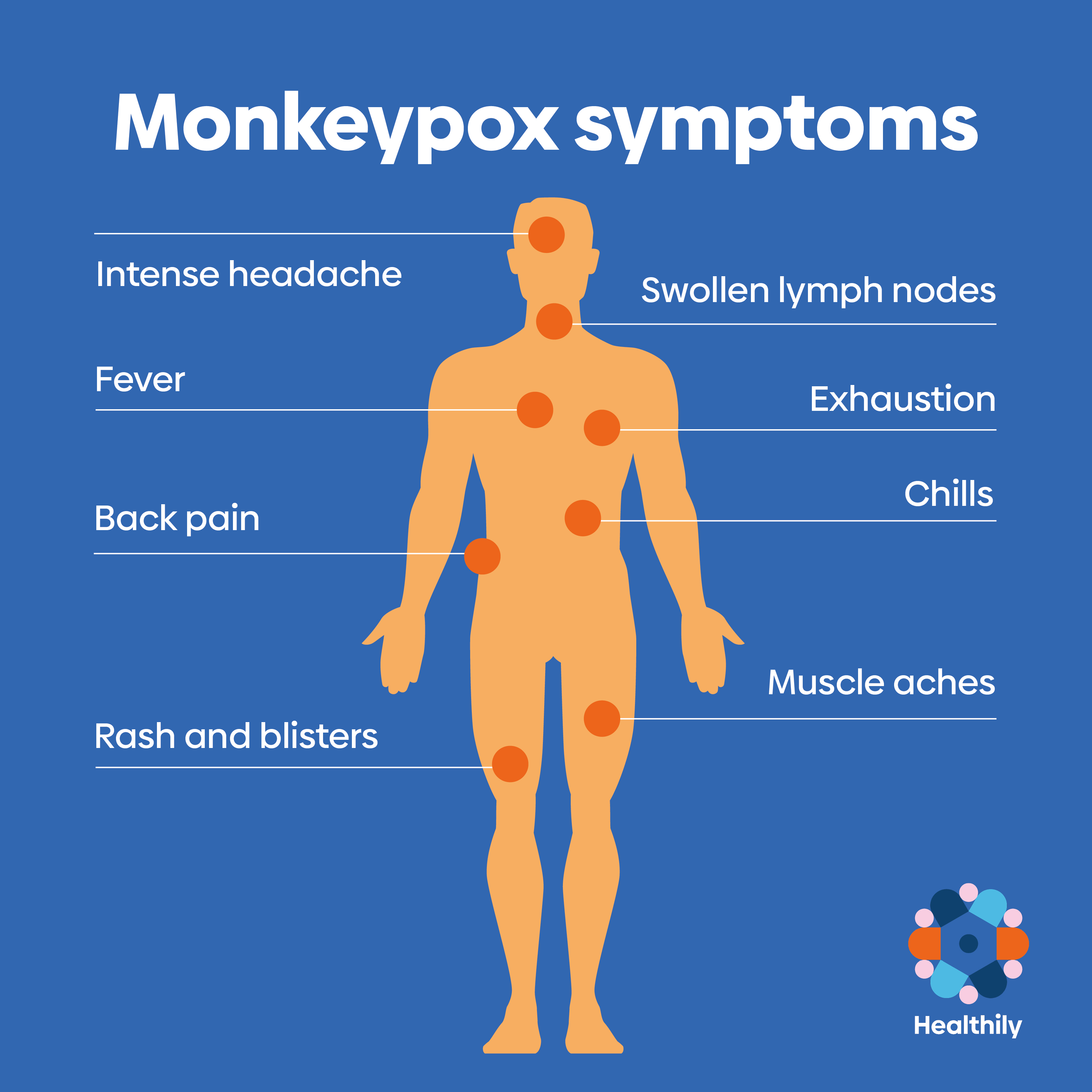 Monkeypox symptoms