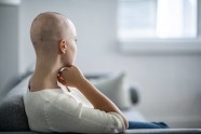 5 Cancer Treatments That Lead To Hair Loss And How To Cope