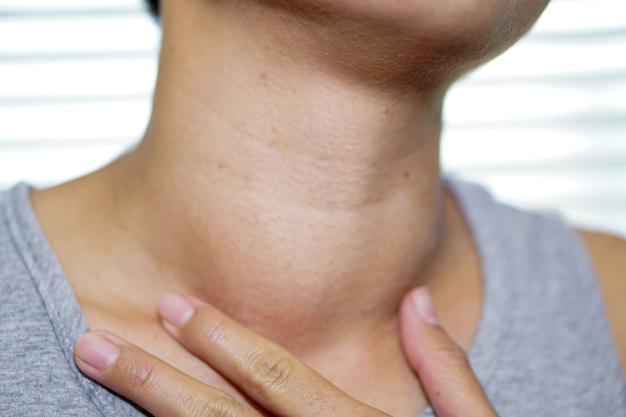 Swelling and lump on neck