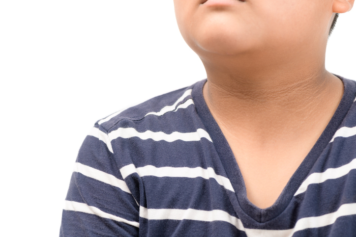 Black marks of the skin around the neck of overweight children