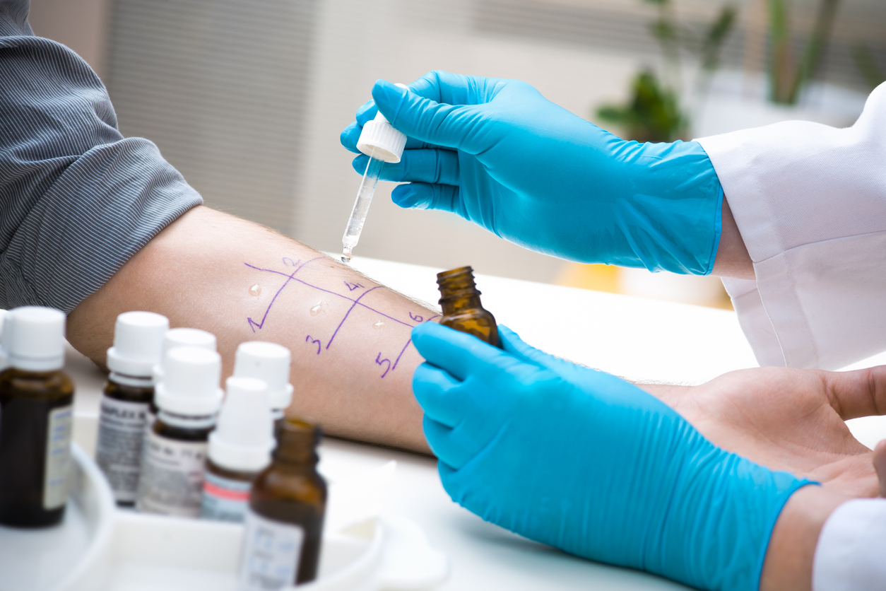 Allergy test for hay fever