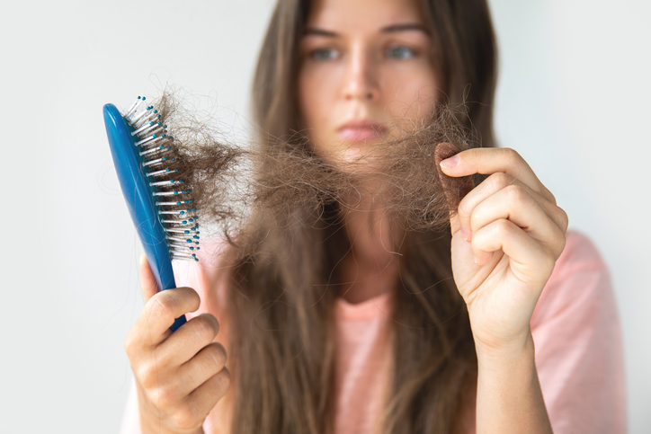 How to manage PCOS hair loss