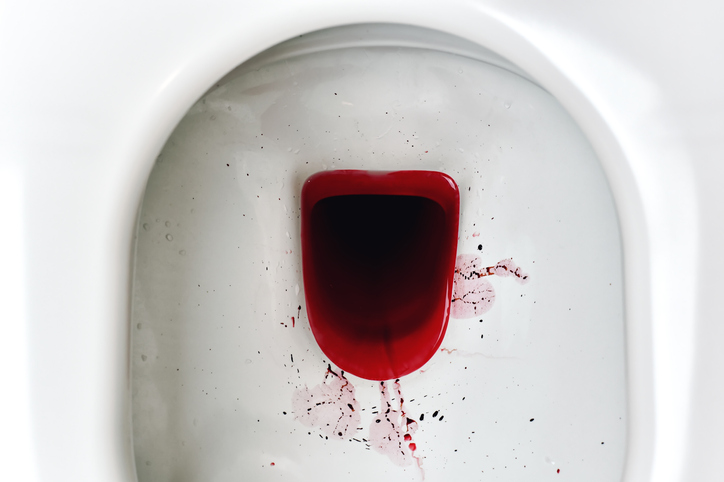Blood in toilet bowl, rectal bleeding 