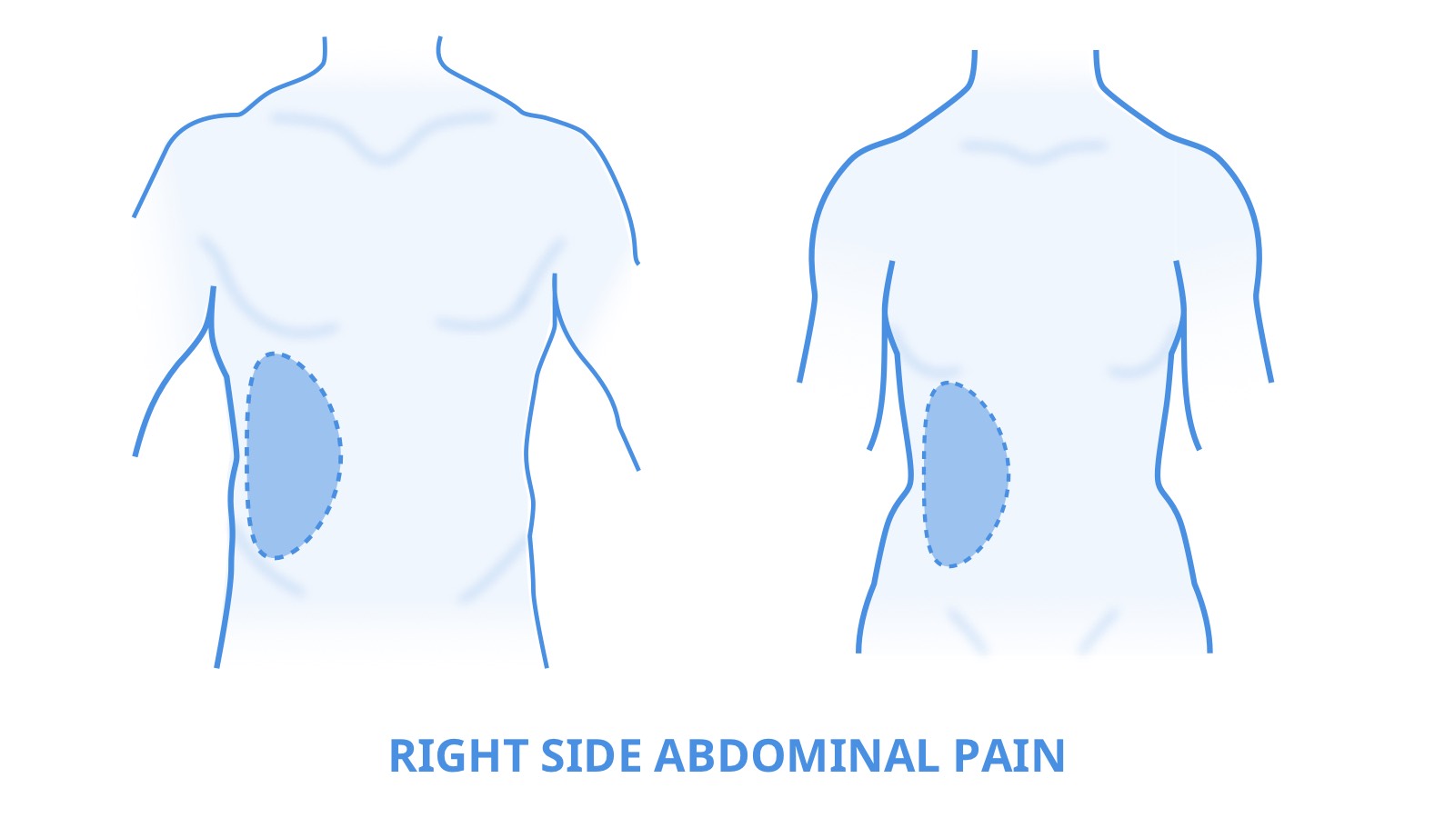 Image highlighting the right side of the abdomen