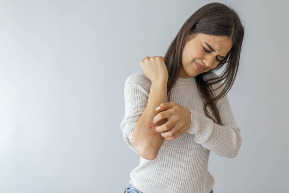 卷起的袖子刮擦皮疹的女人在手臂上可能是地衣平面