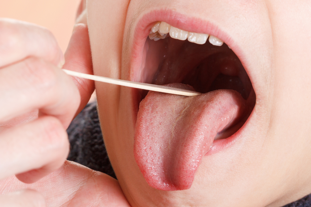 White spots on tonsils: Causes and treatments