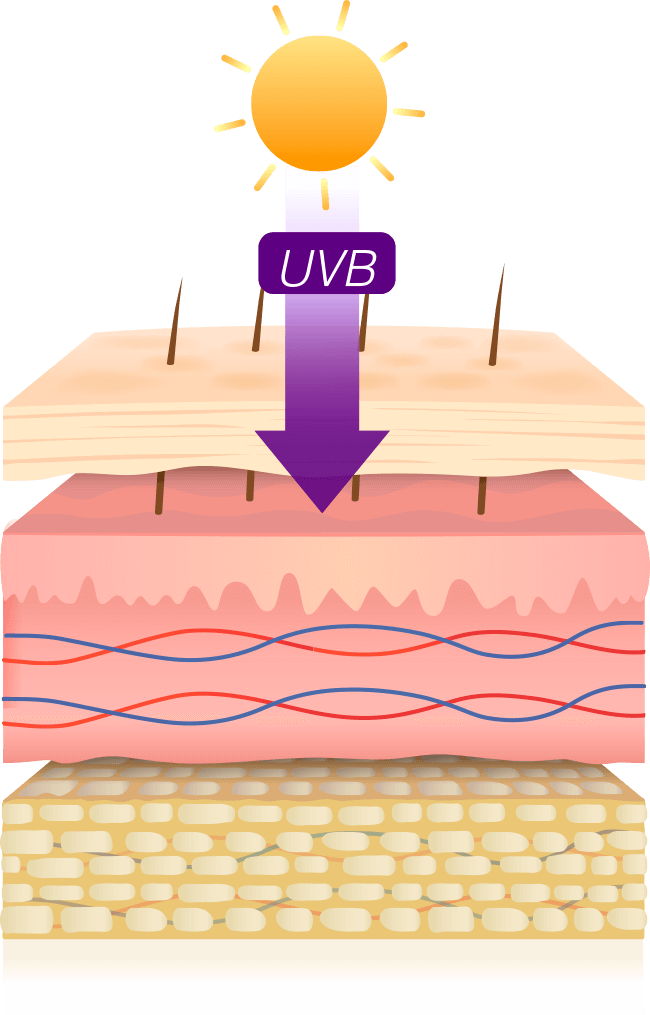 Rayos UVB