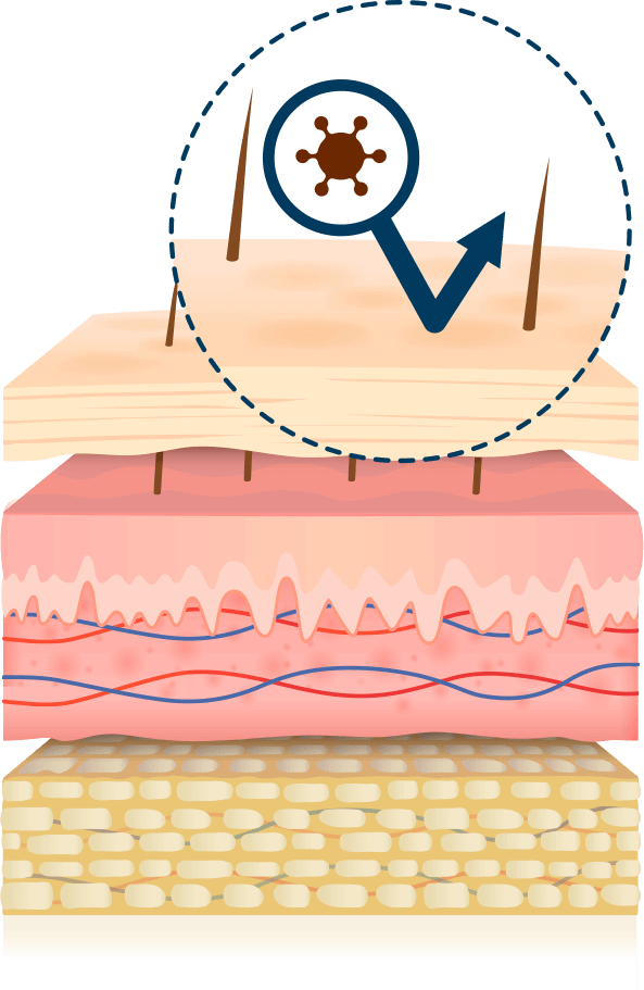 Epidermis