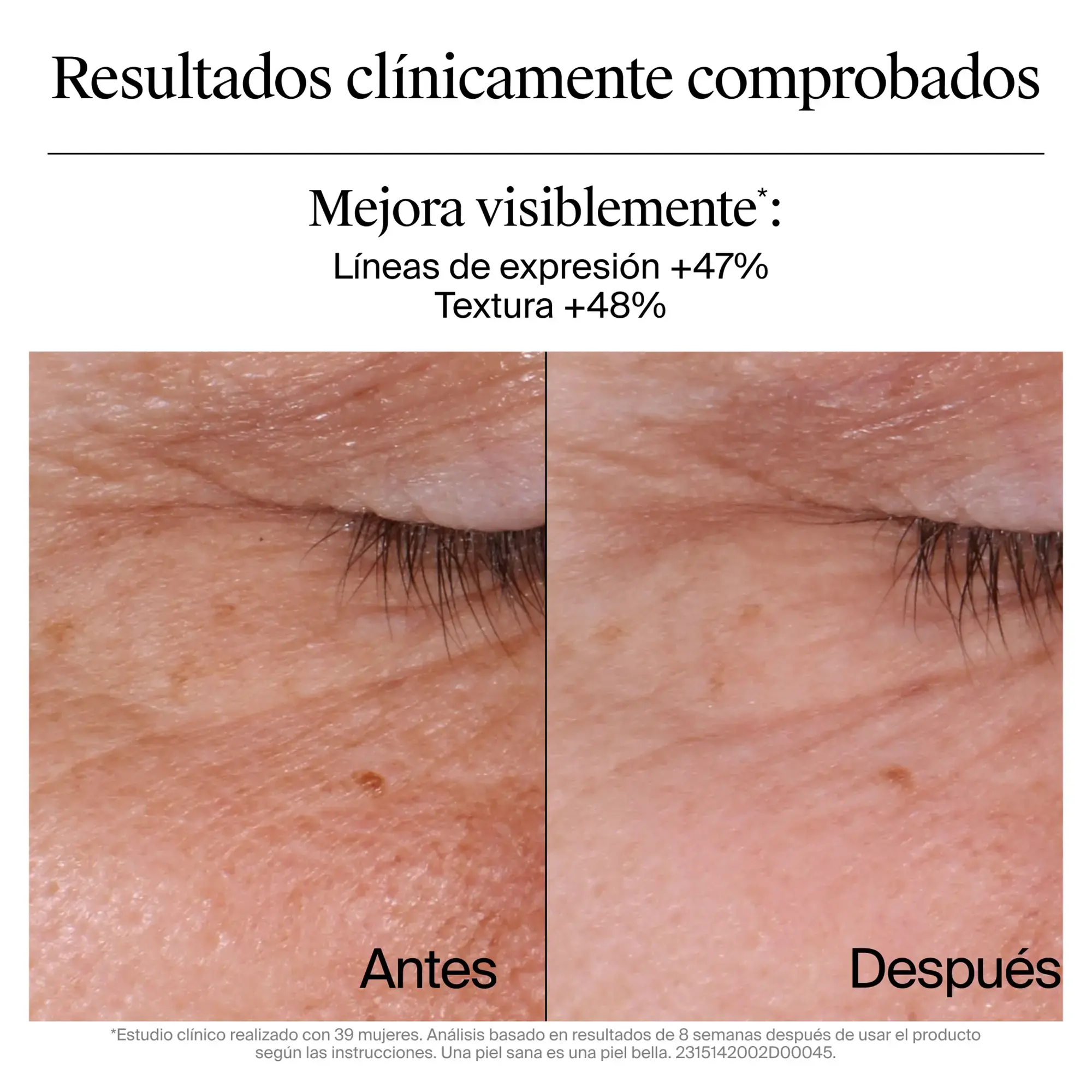 Neutrogena® Crema Anti-Arrugas Retinol Boost con Retinol Puro