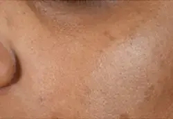 despues