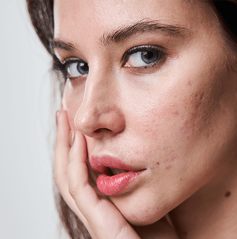 Skin