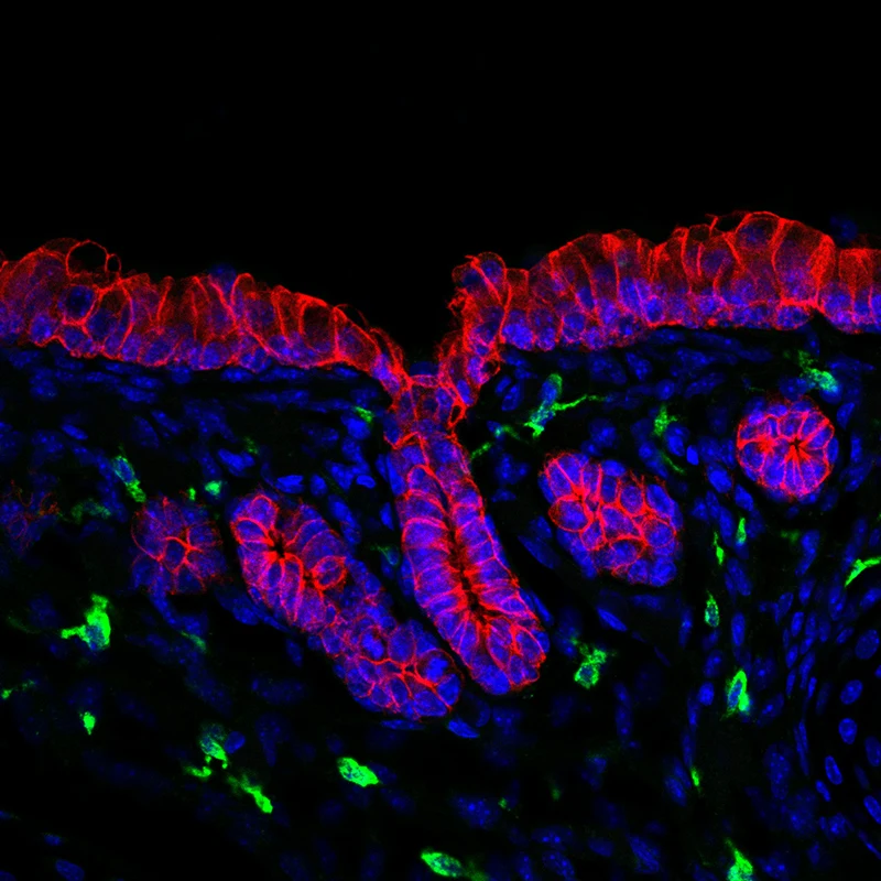 Immune cells (green) of the airway glandular niche. Gland and airway epithelium (outlined in red), nuclei of cells (blue).