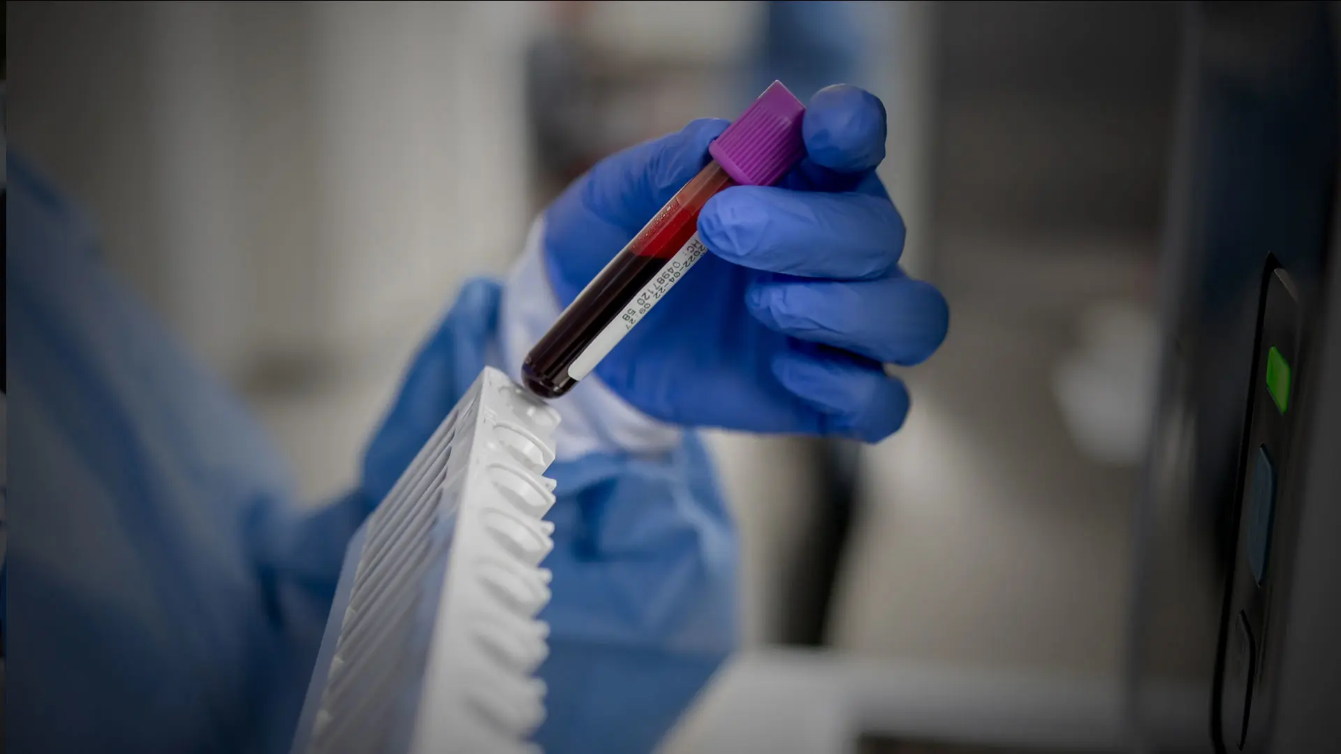 Liquid Biopsy “Reliable and Accurate” With Early Cancer Detection