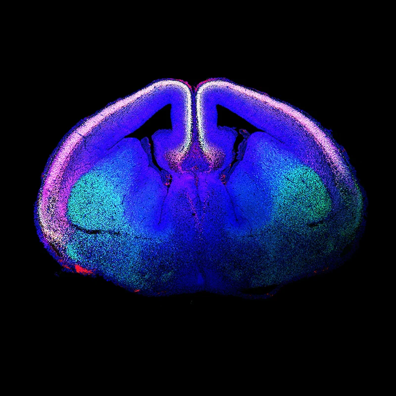 Figure 1. “Rising Life" shows a developing mouse brain, with newborn glutamatergic neurons of the cerebral cortex labeled using immunofluorescence techniques and shown in white. The labeled proteins are CTIP2 (green) and TBR1 (red), with the DNA marker DAPI (blue). White nuclei are glutamatergic neurons that stain for all three. Courtesy of Marta Garcia-Forn, PhD, Postdoctoral Fellow, De Rubeis Lab.