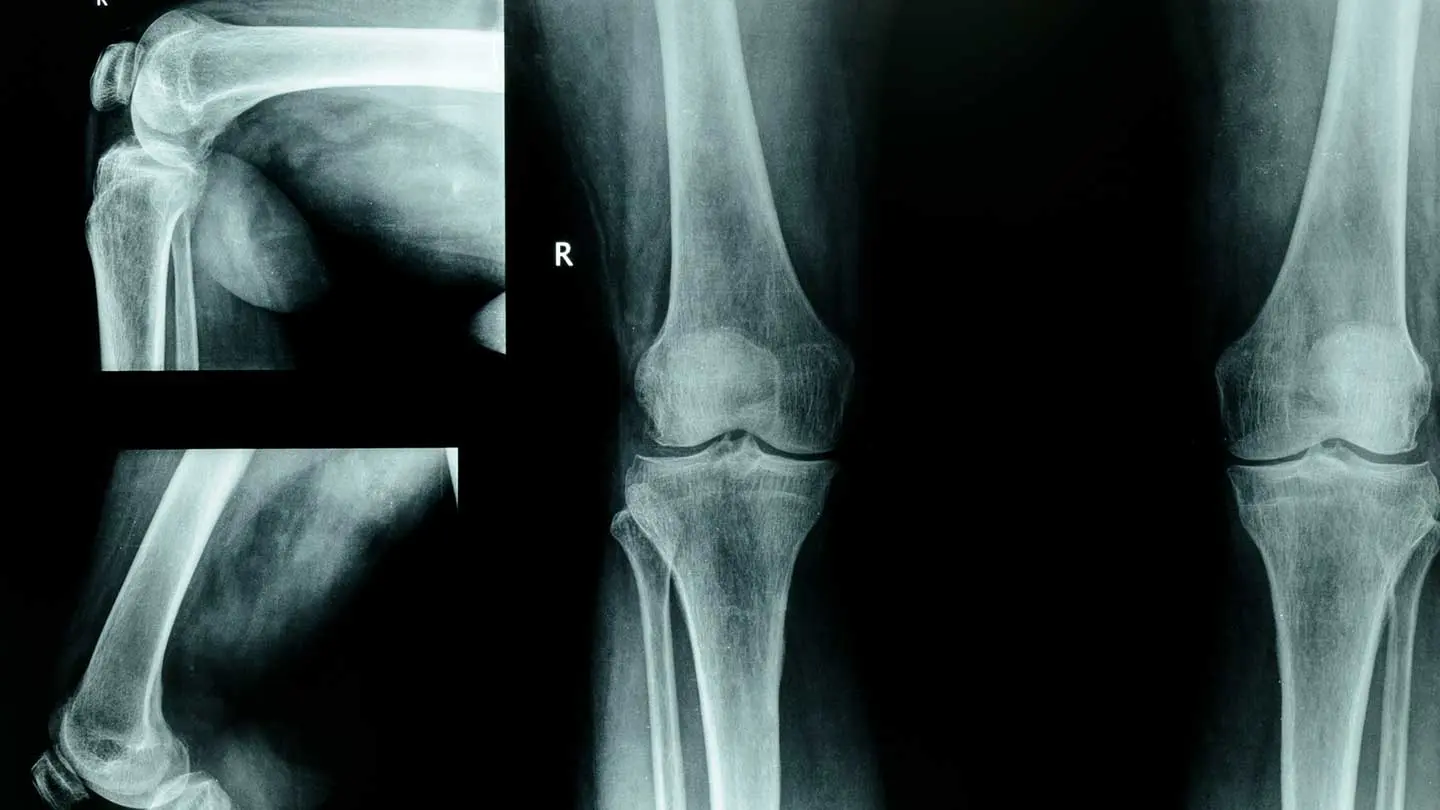 Orthopedic Surgery