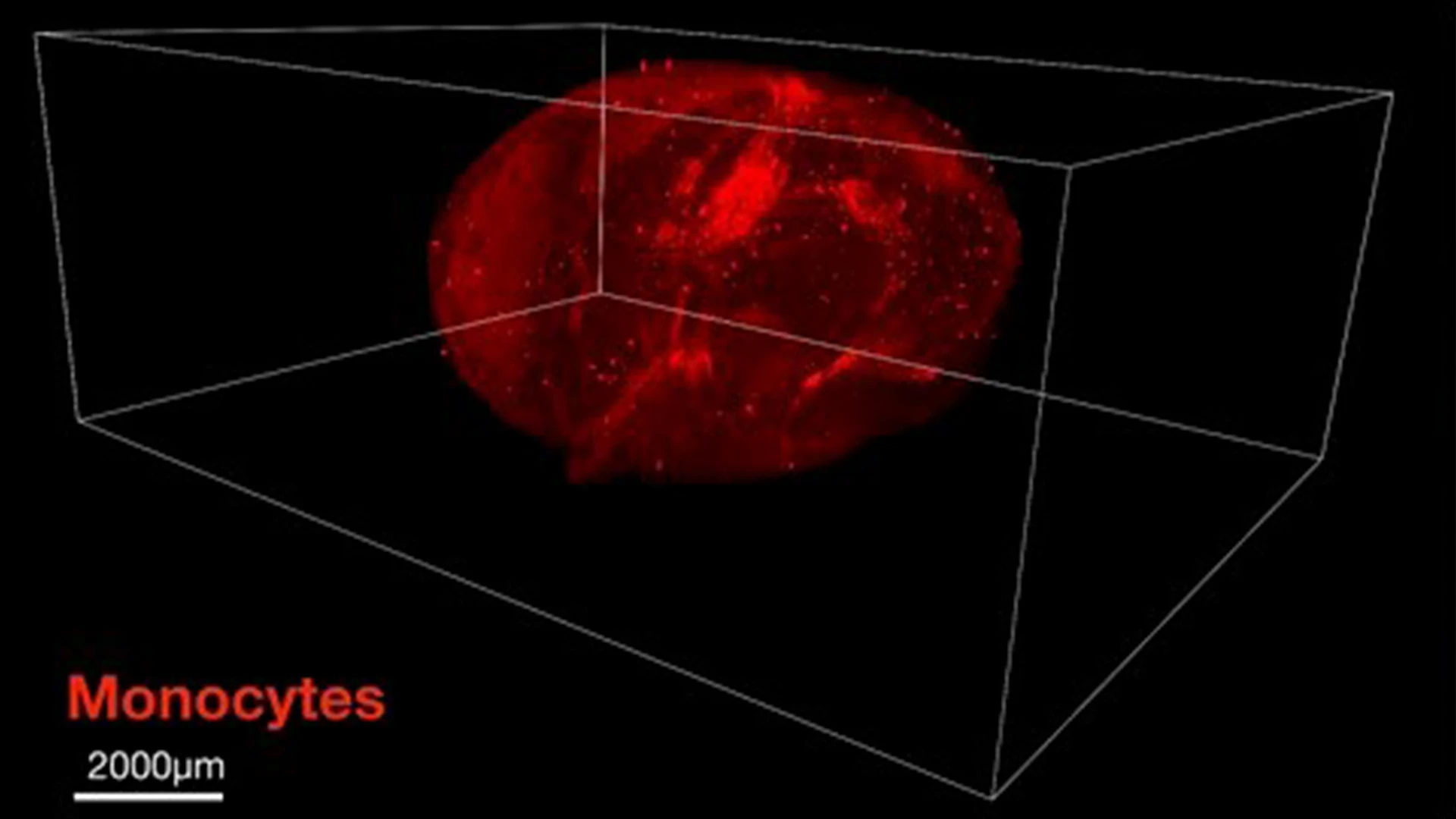 Microscopy images of monocytes in the brain of a mouse after a heart attack. 