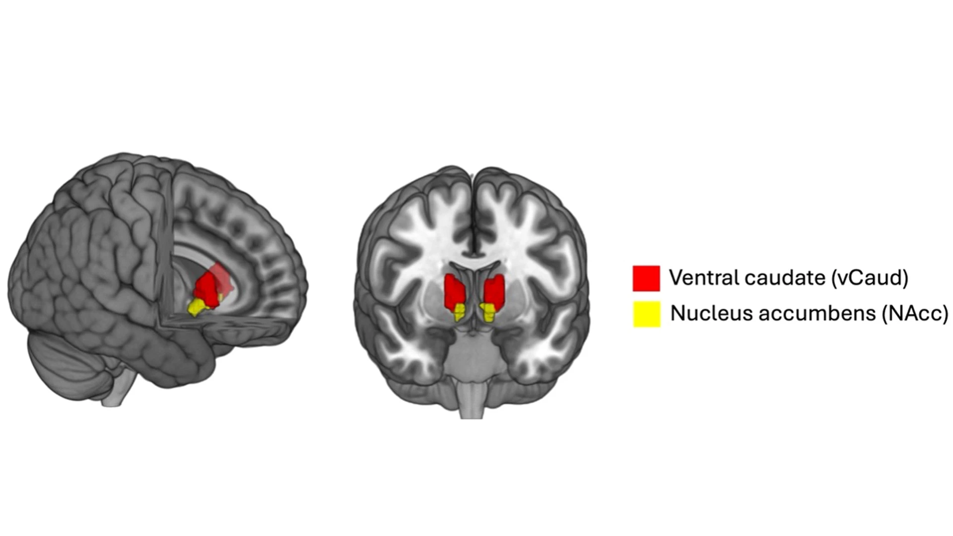 As part of the study, published in Biological Psychiatry, Dr. Murrough conducted MRI scans to assess ezogabine's ability to modulate the resting-state functional connectivity of the brain's reward regions, including the ventral caudate and nucleus accumbens. His team observed significantly reduced connectivity between the reward regions and the posterior cingulate cortex among individuals administered ezogabine compared with placebo.