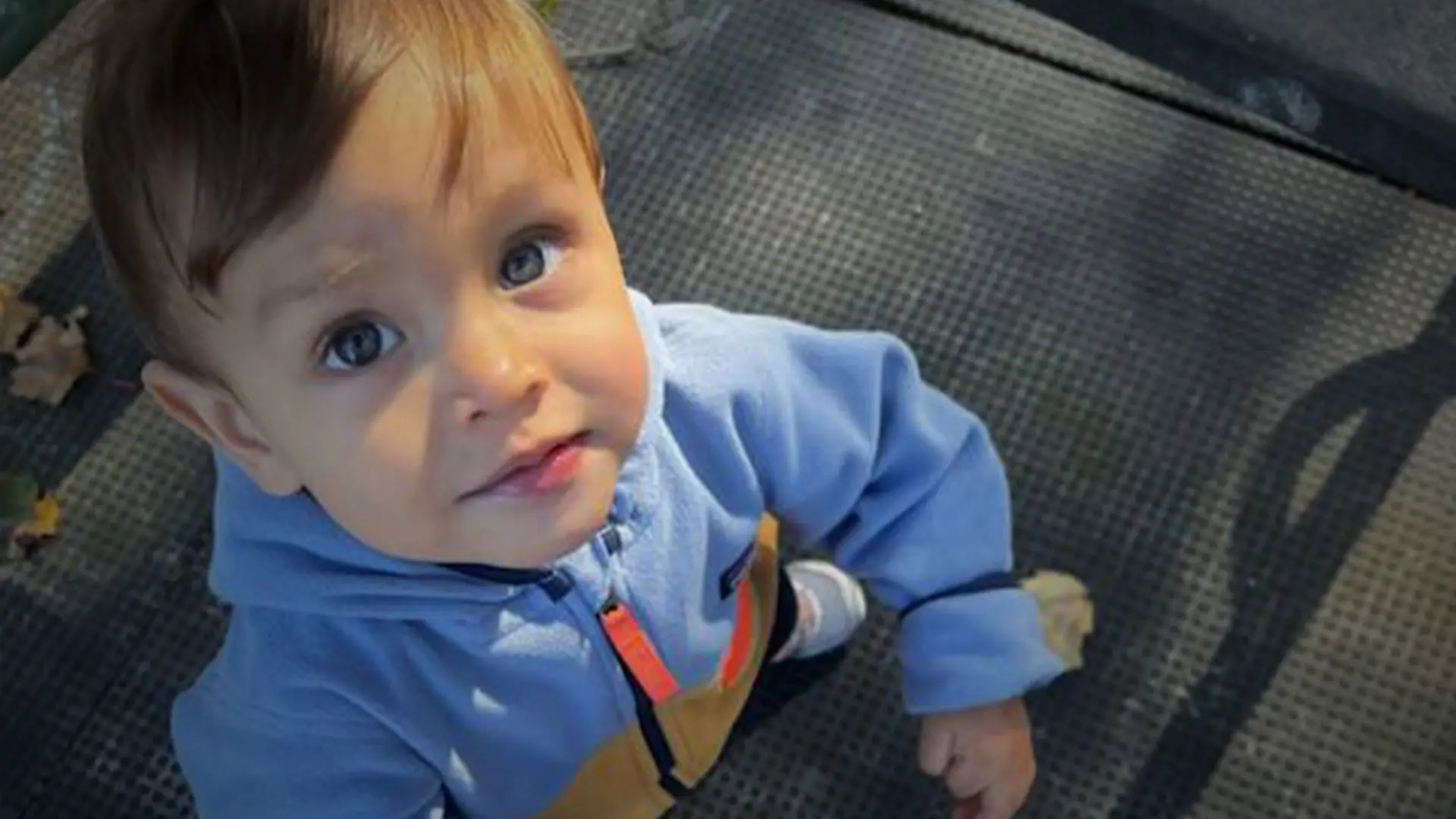 Prenatal Detection of Complex Bilateral Ureteral Obstruction: A Coordinated Multidisciplinary Intervention at Mount Sinai 