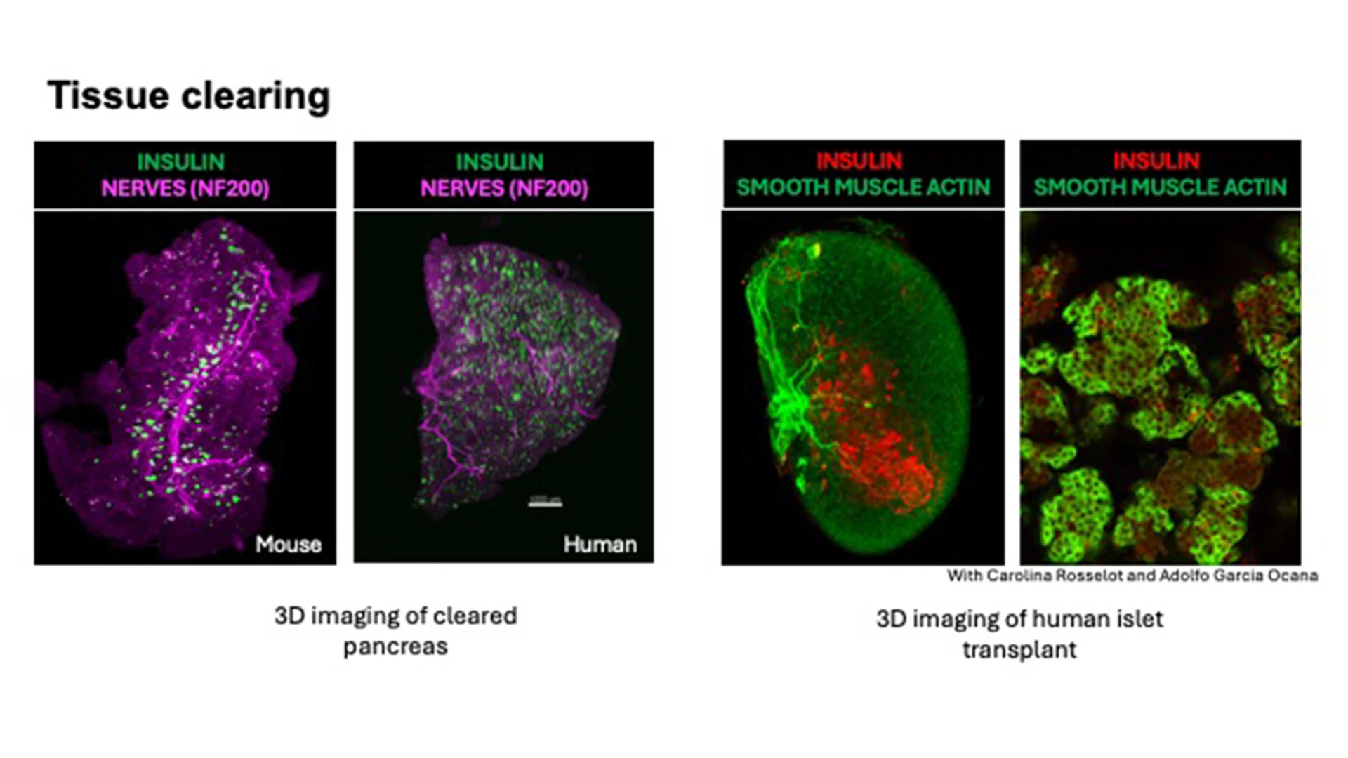 3D imaging of a cleared mouse pancreas, left, and a human pancreas, produced by the Human Islet and Adenovirus Core. 
