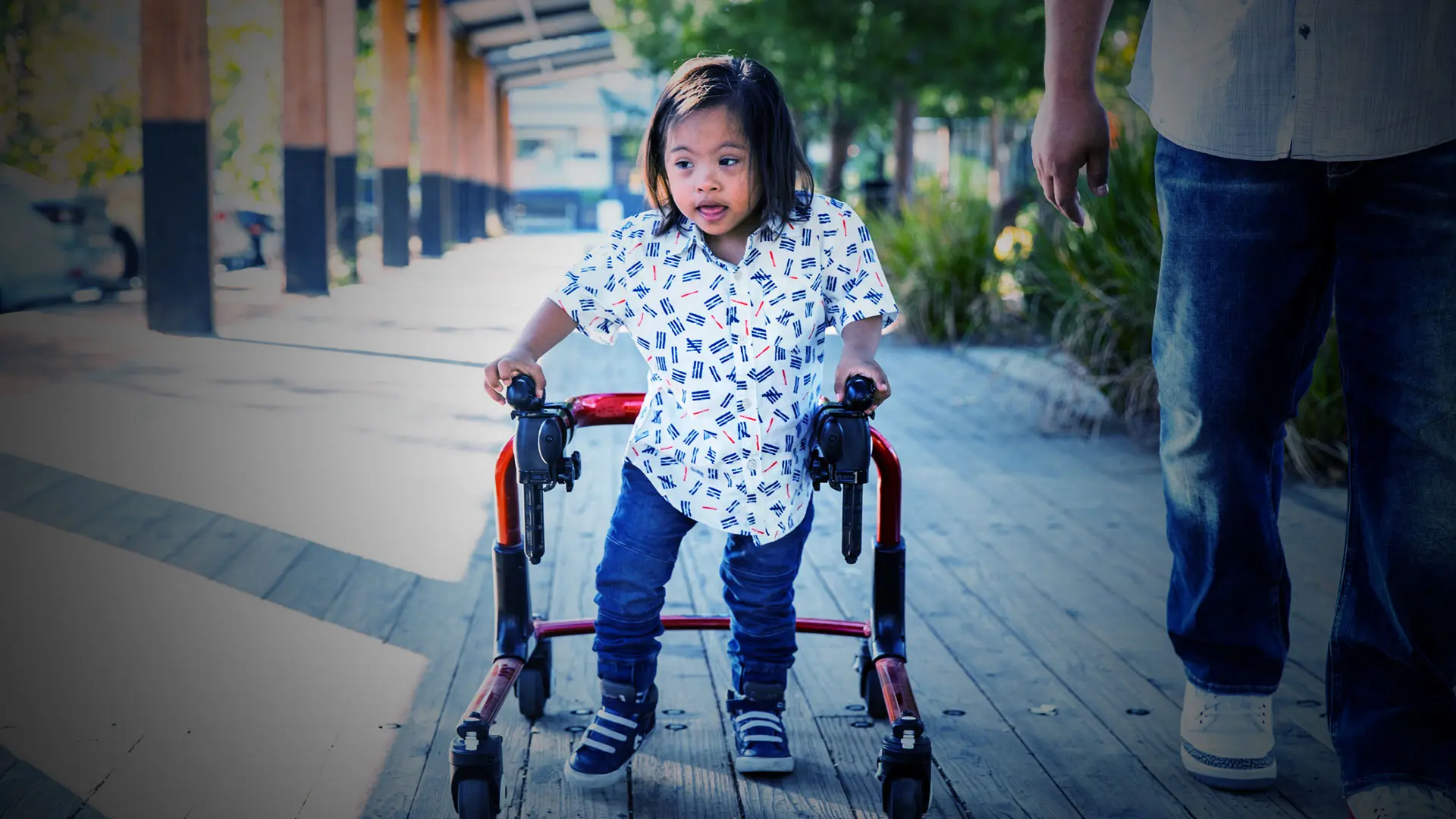 Orthopedists Offer “Go-To” Guidance for Managing Down Syndrome