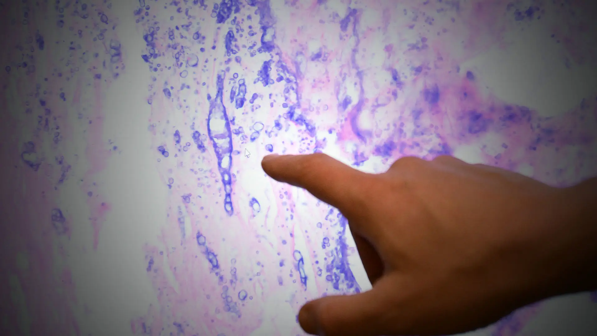 Dermatology Advisory Board Advocates for Research Advancements