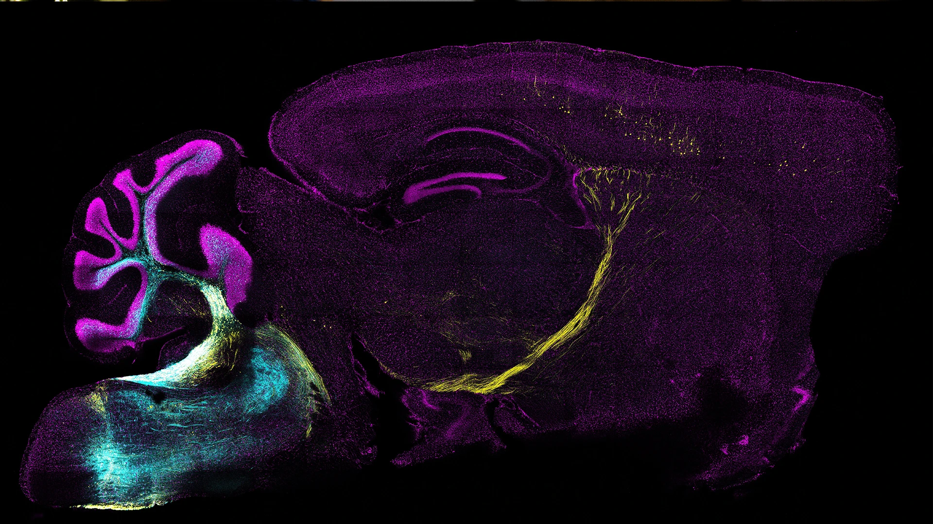 Axonal projections from the inferior olivary nucleus to the lateral septum circuit, which promotes escape behavior. Image Credit: Long Li, PhD, Postdoctoral Fellow and Instructor in the Scott Russo, PhD, Lab, Nash Family Department of Neuroscience.