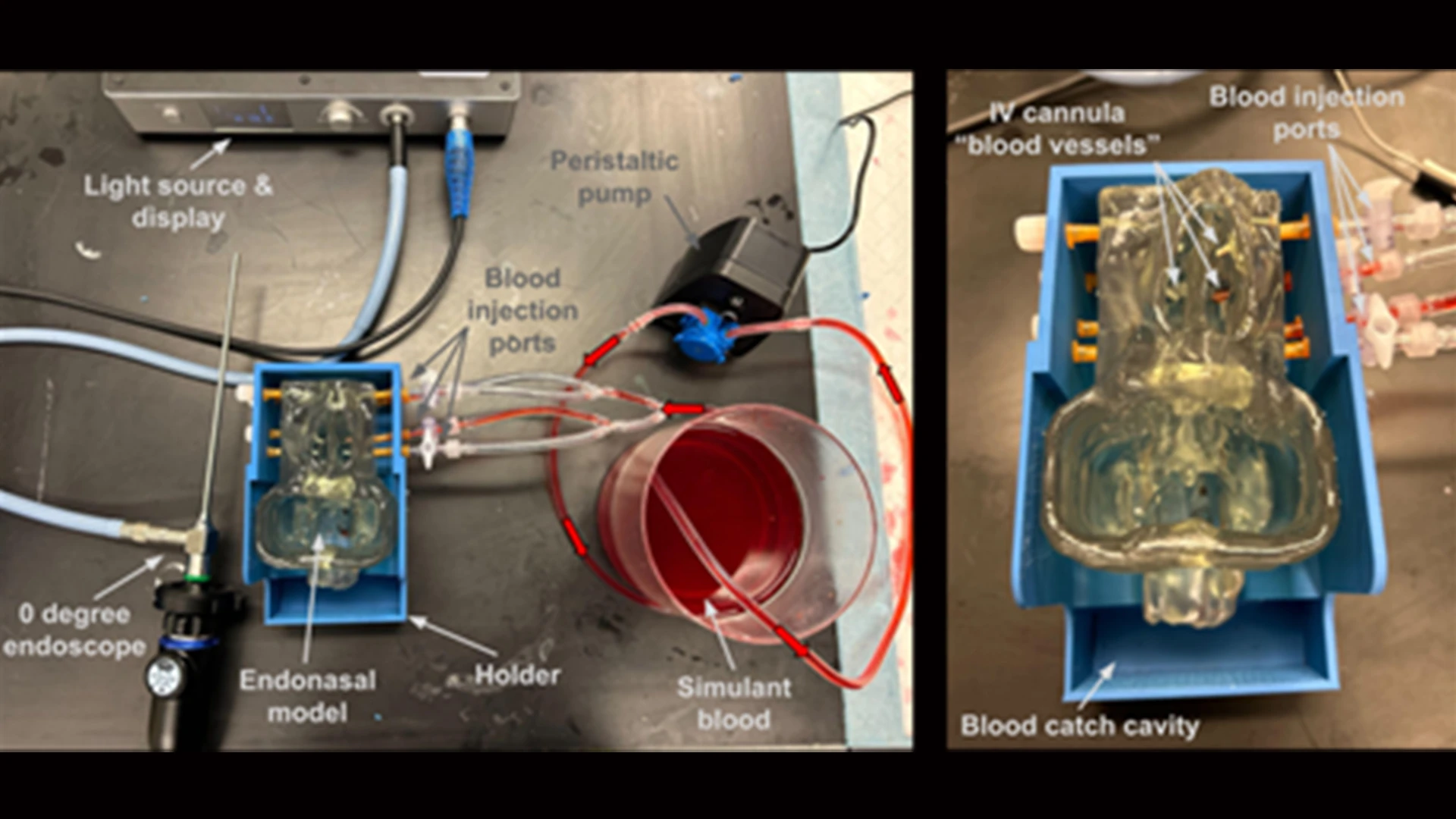 Figure 1. Purpose-built multiformat 3D-printed model used to simulate endoscopic bleeding challenges. The model includes eight anatomically relevant injection ports, each with a peristaltic pump that injects a blood surrogate at a variable infusion rate. Surgeons can use a variety of methods, from hemostatic clips, bipolar cautery, and mechanical tamponade to stop bleeding. 